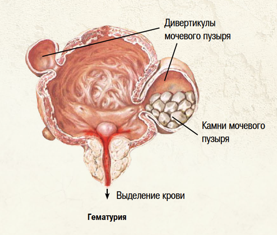 о