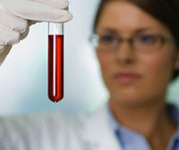 Биохимический тест крови