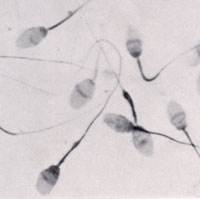 Зрелые сперматозоиды