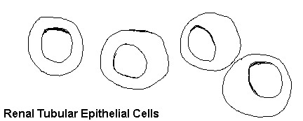 Различные клетки в анализе мочи