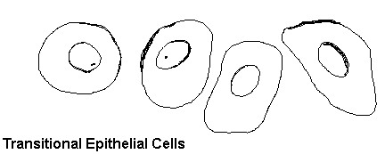 Различные клетки в анализе мочи