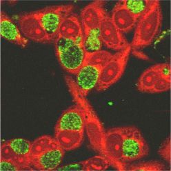 Хламидии при микроскопии - внутриклеточные зеленые включения.